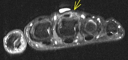 Figure 6 for case Boxers knuckle